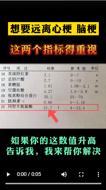 想要远离心梗、脑梗，这两个指标得重视！