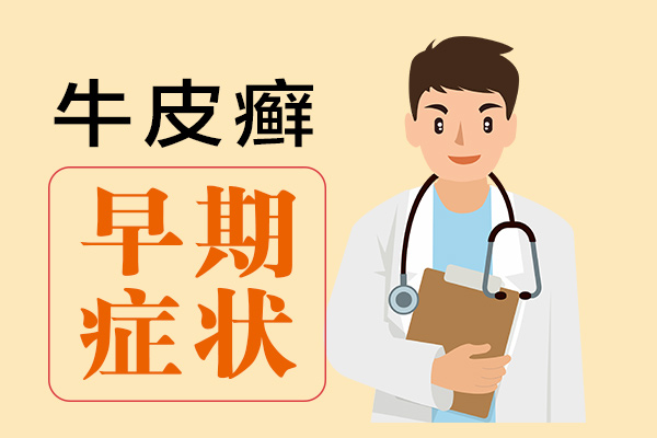 南昌中山皮肤病医院公众号科普初期银屑病的症状有哪些？