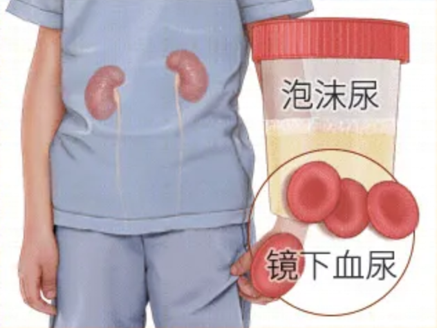 总说紫癜治不好！这几个治好紫癜必备的条件，你有吗？