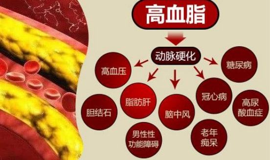 6个不良饮食习惯，越吃血脂越高，看你中了几条？