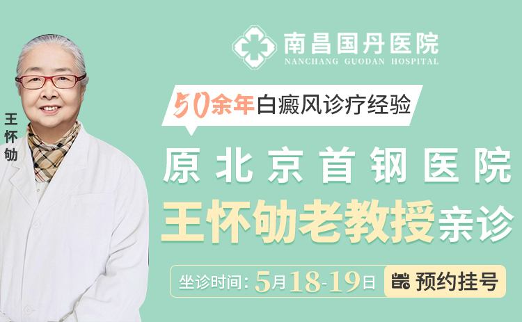 夏季福利活动来袭：5月18-19日北京白癜风专家王怀劬莅临南昌国丹白癜风医院，京赣专家联合会诊活动