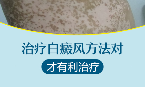 长沙白癜风患者良好的生活习惯有助于治疗白癜风吗？