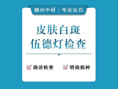 白癜风伍德灯检查