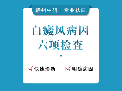 白癜风6项病因检查