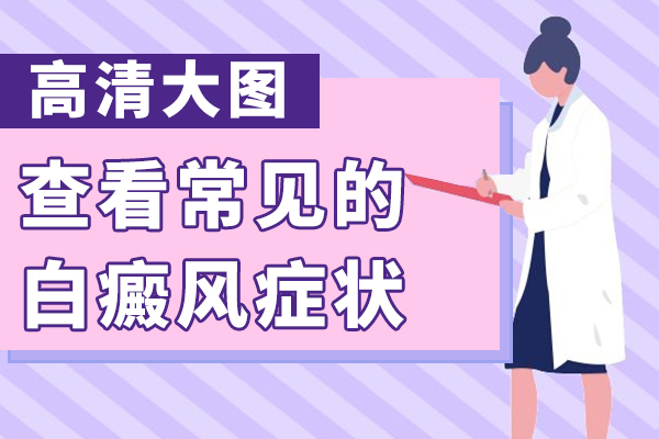 长沙白癜风患者得了白癜风散发性白癜风有哪些症状呢？