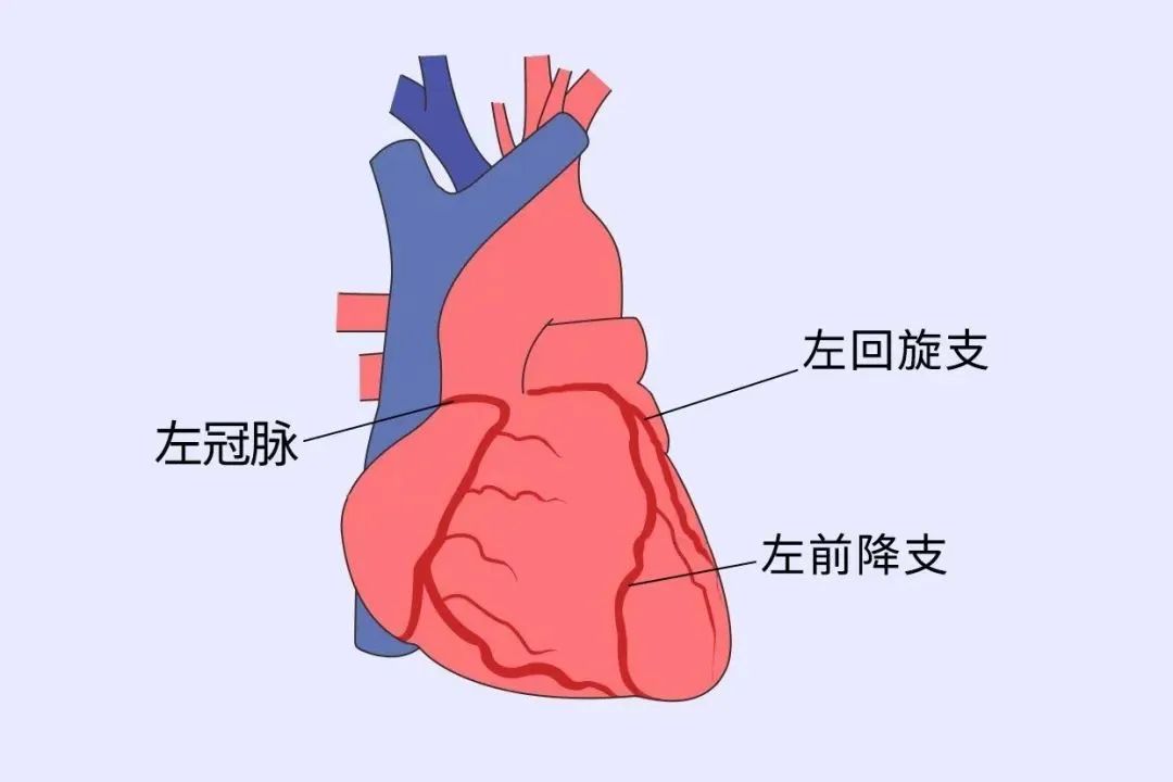 心脏哪根血管堵了，最要命？记住两点，预防心梗
