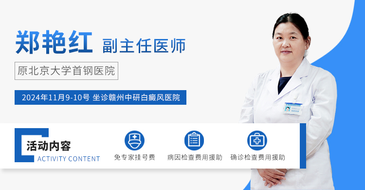 北京白癜风专家郑艳红11月9-10日坐诊赣州中研，公益白斑普查活动进行中！