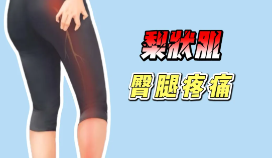 健康科普丨有一种屁股痛叫“梨状肌综合征”