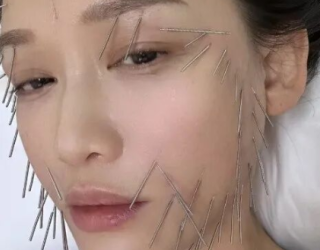 听说女明星都在做的“针灸美容”火了？快来体验一下“中式医美”！