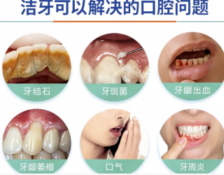 洗牙伤牙、牙缝变大？几个洗牙真相，越早知道越好！