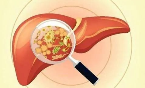 【肝病是怎么分类的？】—广东广州华港中医肝病医院