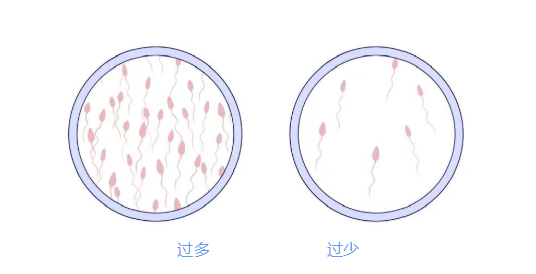 【肾的健康程度看小蝌蚪】—新蔡县博爱门诊部